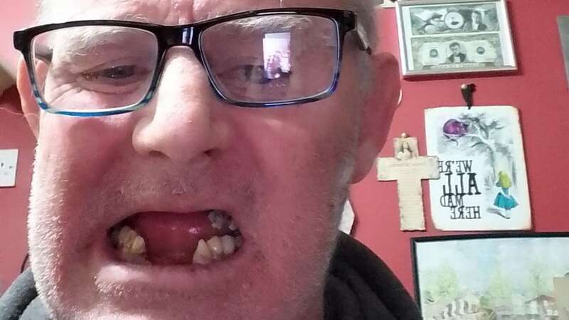 John Molloy has pulled several teeth out himself (Image: No credit)