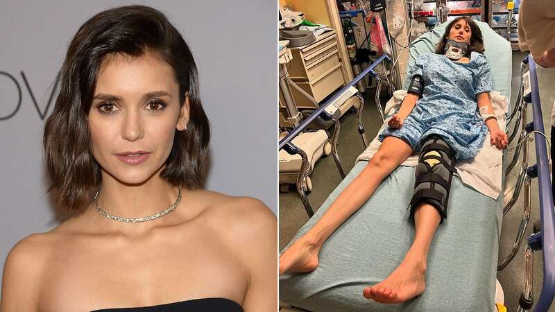 Nina Dobrev posted her injuries on social media (Image: No credit)