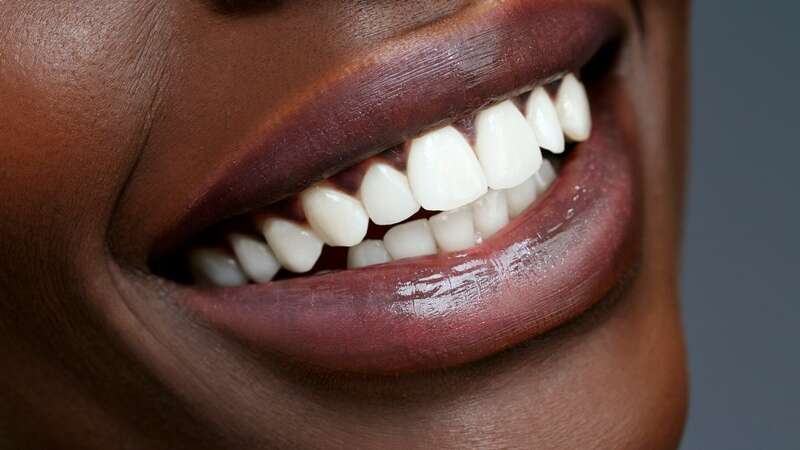 Enhance your smile with these new whitening strips (Image: Getty)