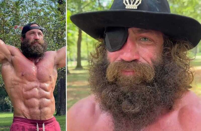 The reason why American fitness influencer and businessman Brian Johnson was wearing an eye patch