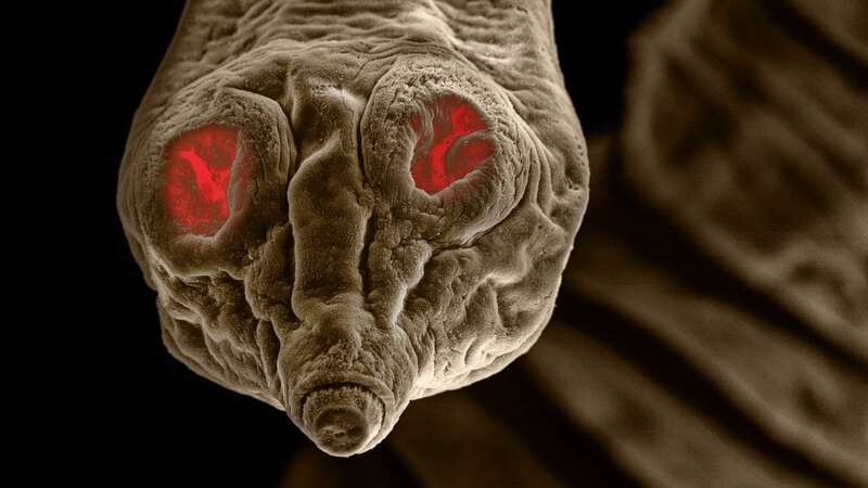 Microscopic pictures show the tapeworms and roundworms in all their gory detail (Image: Dr David Maitland/SWNS)