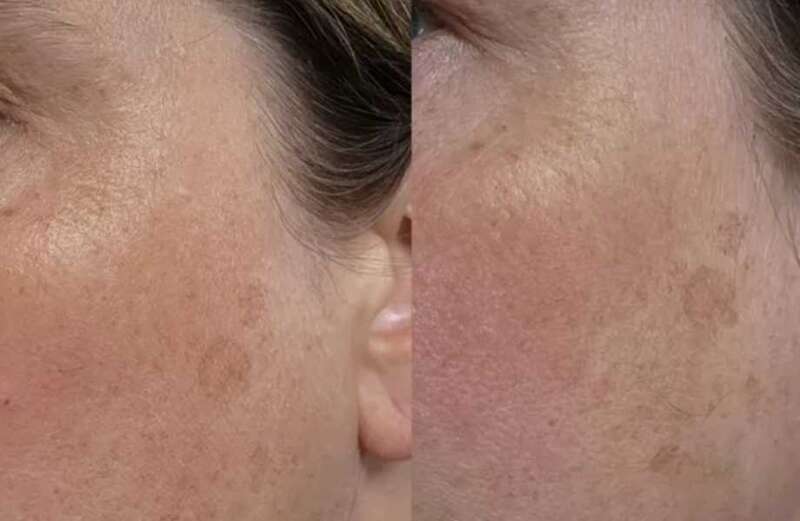 Women saw a noticeable difference after just one week of use