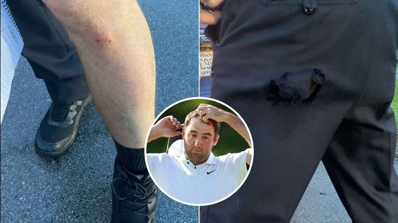 New photos have revealed the injuries that a Louisville police officer sustained during a traffic incident with Scottie Scheffler (Image: Jorge Lemus/NurPhoto via Getty Images)