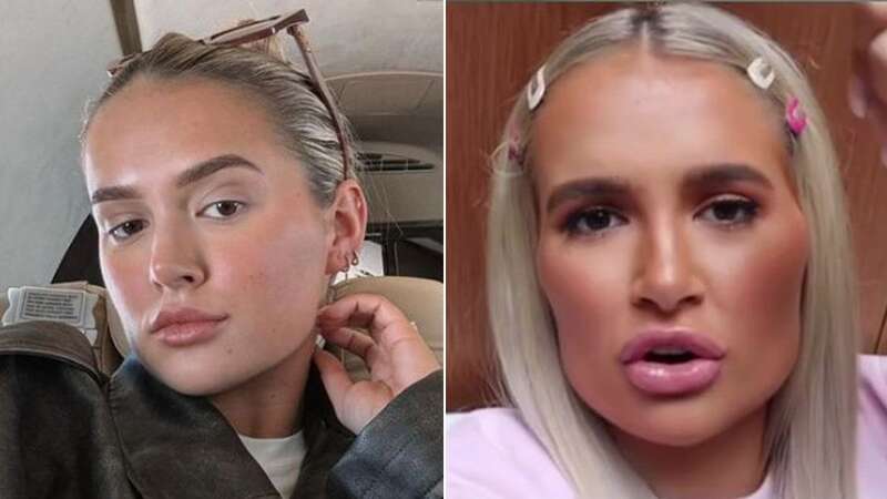 Molly-Mae Hague shares major update on filler use in candid confession