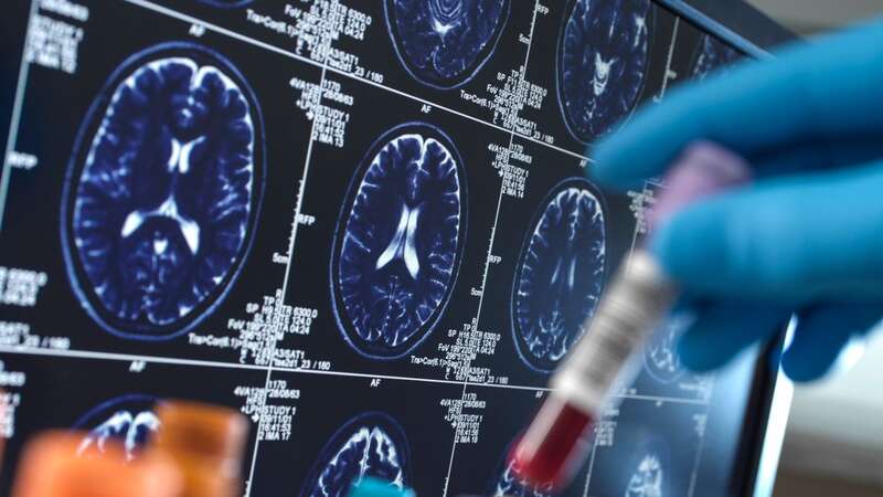 The new test uses MRI scans (Image: Getty Images/Image Source)