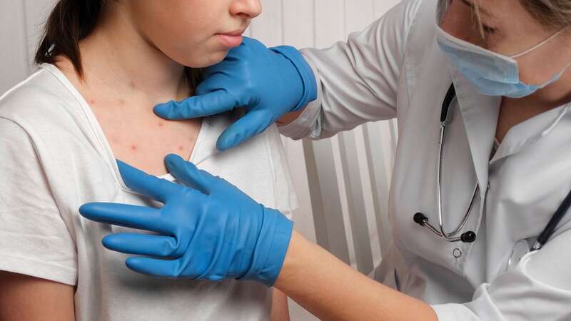 Measles cases are on the rise (Image: Getty Images)