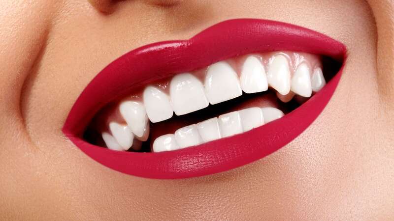 The £25 teeth whitening powder is great for maintaining a stain-free, white smile (Image: Getty Images)