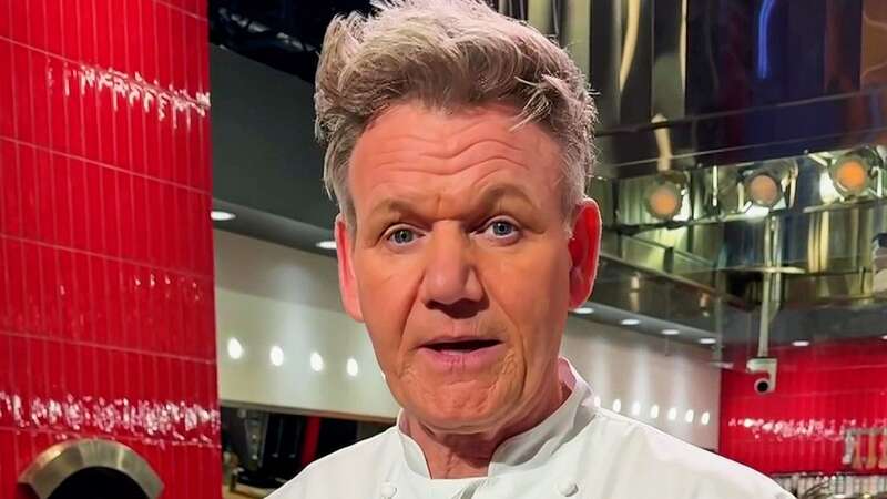 Gordon Ramsay shows off horrific injuries after near-death road traffic accident