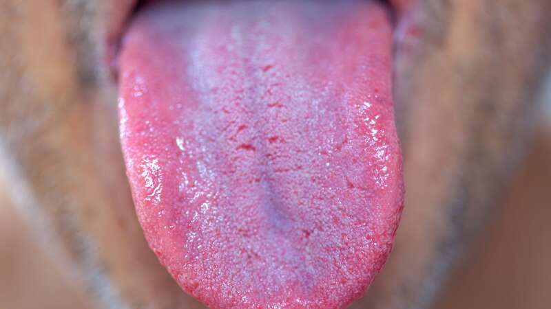 This quick tongue test could reveal a surprising amount about your health (stock image) (Image: Getty Images/iStockphoto)