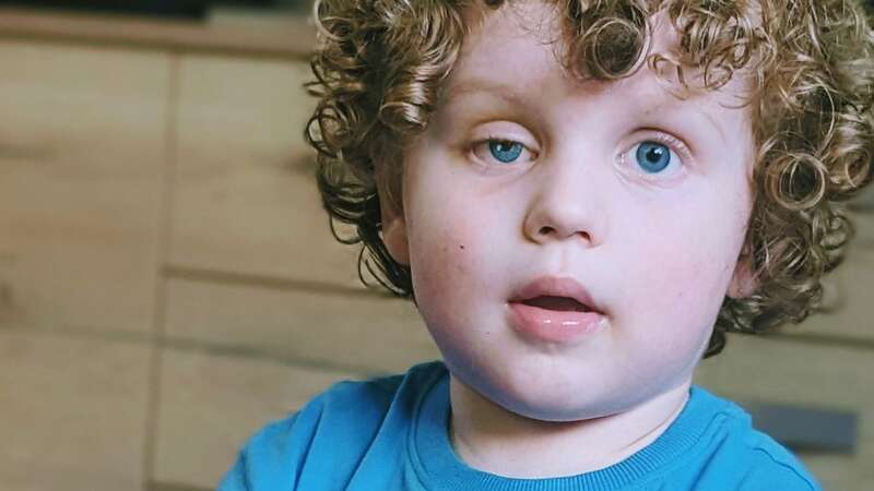 Teddy now has a prosthetic eye (Image: Amy Waddle/SWNS)