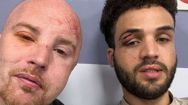 Jordan Brook and Daniel Timothy after the attack (Image: Daniel Timothy / SWNS)