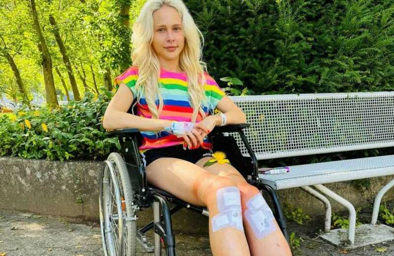 The real-life Barbie looks to achieve supermodel status with her new extended pegs after undergoing surgeries since 2016