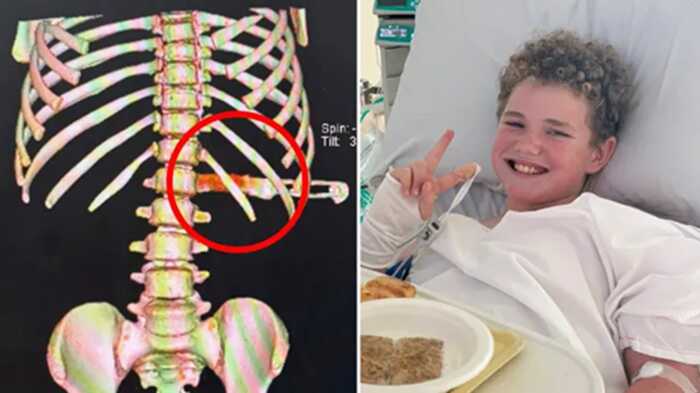 Boy narrowly escapes paralysis after tripping onto kitchen knife in dishwasher